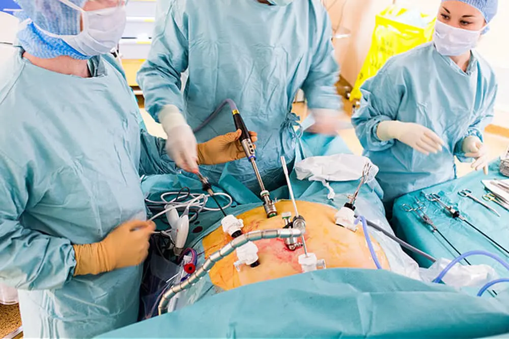 أنواع جراحات السمنة في الرياض مع الدكتور ماجد العنزي