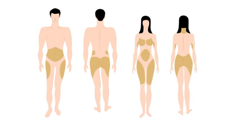 كيف يختار الدكتور ماجد العنزي العملية الأنسب حسب شكل الجسم وتوزيع كمية الدهون؟