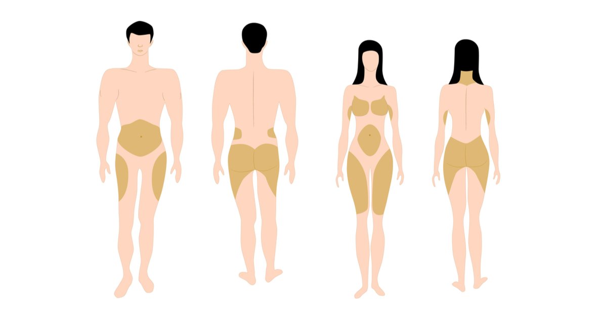 كيف يختار الدكتور ماجد العنزي العملية الأنسب حسب شكل الجسم وتوزيع كمية الدهون؟